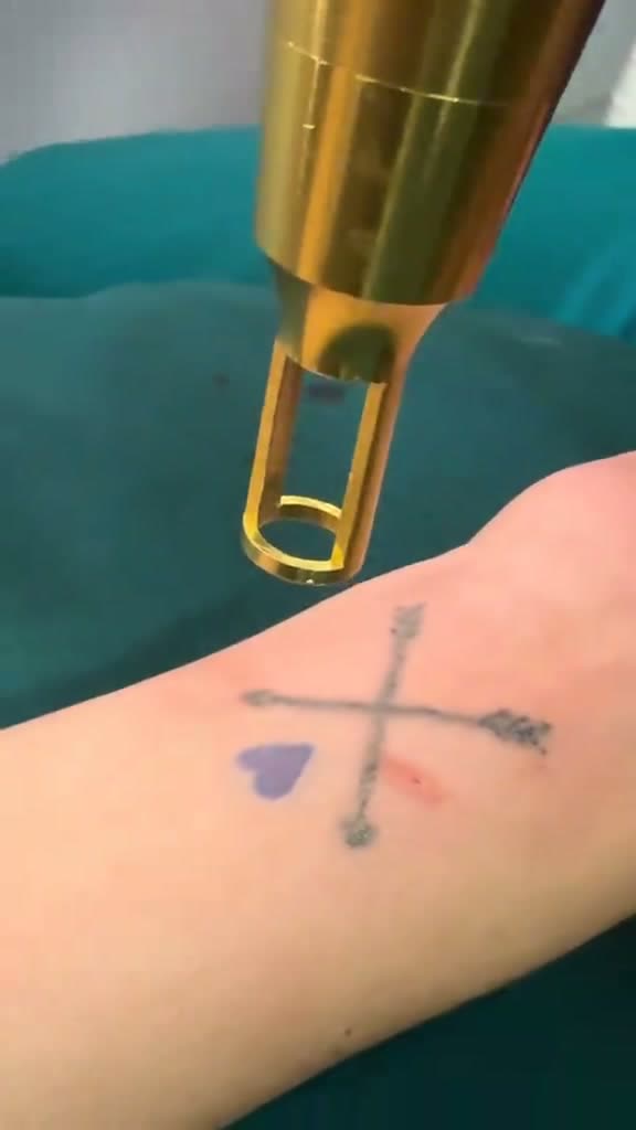 Tatuaje de flechas cruzadas con la pieza del láser